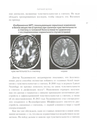 Книга: Еда и мозг. Что углеводы делают со здоровьем, мышлением и памятью (Новая обложка) EKS-953463